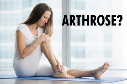 Frau hat Arthrose